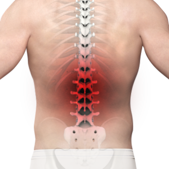 Back Pain