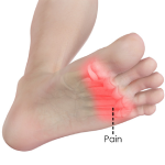 Forefoot Pain